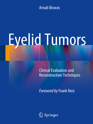cover image of Eyelid Tumors